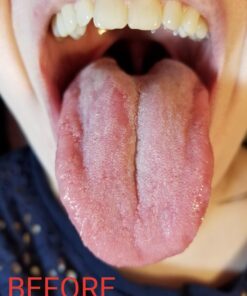 Orabrush Tongue Scraper, Tongue Cleaner Helps Fight Bad Breath, 4 Tongue Scrapers 4 Count (Pack of 1) Multicolored 30 71ELl2hwTL