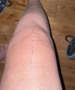 Dr. Nordyke's Wound Honey New Zealand Manuka Honey for Infections,Burns,Cuts and Scars (80g) 2.8 Ounce (Pack of 1) 27 71Egkc2sXTL