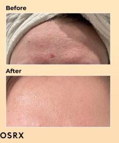 COSRX Snail Mucin 96% Power Repairing Essence 3.38 fl.oz 100ml, Hydrating Serum for Face with Snail Secretion Filtrate for Dull Skin & Fine Lines, Korean Skincare Snail Essence 25 71Ev K7FS3L