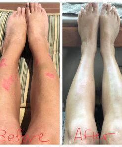 MG217 Psoriasis Treatment, Medicated Conditioning 2% Coal Tar Multi-Symptom Ointment, 3.8 Ounce Discontinued 3.8 Ounce 20 71EyMNhg8XL