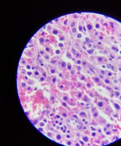 SWIFT SW350T 40X-2500X Magnification, Siedentopf Head, Research-Grade Trinocular Compound Lab Microscope with Wide-Field 10X and 25X Eyepieces, Mechanical Stage, Abbe Condenser, Camera-Compatible 39 71EyjKVQ3RL