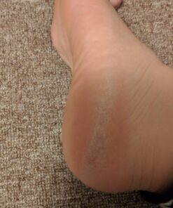 Microplane Colossal Foot File Scraper - The Original Stainless Steel Foot Rasp, Dead Skin/Callus Remover for Feet, Gentle Foot Scrubber, Pedicure Tools for Salon-Quality Foot Care, Black 58 71FaibtrKsL