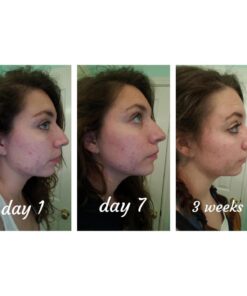 Manuka Honey Face Wash for Women and Men - Moisturizing Face Wash for Dry Skin with Organic Aloe Vera - Soothing Gentle Face Cleanser Made in USA - Sulfate Free Facial Cleanser for Dry Skin 4 oz 4 Fl Oz (Pack of 1) 25 71GDR9mBdUL