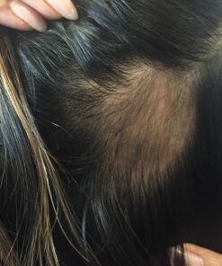 Naturenetics HairAnew Hair Growth Vitamins for Women & Men - Hair Vitamins For Faster Hair Growth & Thickness - Part of Proceeds go to Hair Loss Charity - Vegan Hair Supplement For Hair Skin Nails (1) 1 34 71GGOpmdxPL