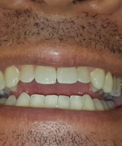 Zen Charcoal Hardwood Activated Charcoal Powder, 100% USA Trees, 8 oz 8 Ounce (Pack of 1) 37 71GwWkENUmL