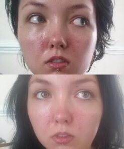 MIZON Snail Line, Snail Repair Intensive Ampoule, Wrinkle Care, Skin Nutrition (30ml 1.01 fl oz) 38 71HGXmYb1pL