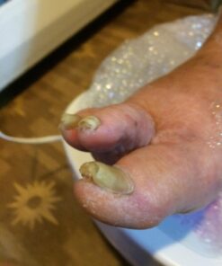 Harperton Podiatrist Toenail Clippers, Heavy-Duty Grooming Tool, Precision Nail Clipper for Thick or Ingrown Toenails, Stainless Steel, Black Toenail Clipper 59 71HRVc8PfIL