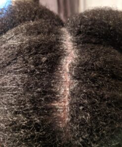 Neutrogena T/Sal Therapeutic Shampoo, Scalp Build-Up Control 4.5 oz, 130 fl oz 4.5 Fl Oz (Pack of 1) 31 71HU6m0ey0L