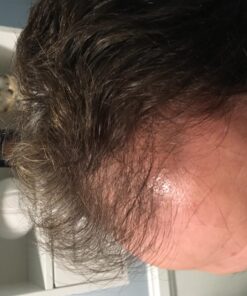 Hairgenics Pronexa Clinical Strength Hair Growth & Regrowth Therapy Hair Loss Shampoo With Biotin, Collagen, and DHT Blockers for Thinning Hair, 8 fl. oz. 51 71HjuG6uX0L