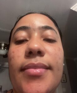 TruSkin Tea Tree Clear Skin Super Serum, Formulated with Tea Tree Oil, Vitamin C, Salicylic Acid, Niacinamide & Retinol, 1fl oz 1 Fl Oz (Pack of 1) 42 71IIDfbO9FL