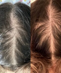 Propidren by HairGenics - DHT Blocker & Hair Growth Capsules to Prevent Hair Loss & Stimulate Hair Follicles, to Stop Hair Loss & Regrow Hair. Proprietary Anti-Hair Loss & Hair Regrowth Treatment. 33 71ILiGK UYL 1