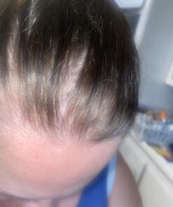 PURA D'OR Professional Grade Biotin Anti-Hair Thinning Shampoo & Conditioner, CLINICALLY TESTED Proven Results, 2X Concentrated DHT Blocker Thickening Products For Women & Men, Sulfate Free, 16oz x 2 29 71IWeGZAeL 2