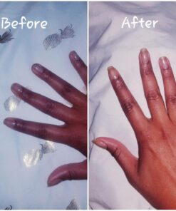 Natrol Biotin Beauty Tablets, Promotes Healthy Hair, Skin and Nails, Helps Support Energy Metabolism, Helps Convert Food Into Energy, Maximum Strength, 10,000mcg, 100 Count (Pack of 1) 100 Count (Pack of 1) 44 71IfgyOZBuL