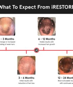 iRestore Essential Laser Hair Growth System - FDA Cleared Hair Loss Treatments for Men & Women & Hair Growth Products for Men with Thinning Hair, Hair Regrowth Treatments Laser Cap, Red Light Therapy 30 71IhQy05WbL 1