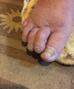 Harperton Podiatrist Toenail Clippers, Heavy-Duty Grooming Tool, Precision Nail Clipper for Thick or Ingrown Toenails, Stainless Steel, Black Toenail Clipper 60 71JsEr8w53L