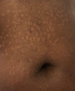 PURELY NORTHWEST-Natural Tea Tree & Peppermint Body Wash for Men & Women-Refreshing Daily Soap for Body Odor & Hygiene, Acne-Effectively Soothes Jock Itch, Chafing & Athletes Foot-Discolored Nails-9oz 9 Fl Oz (Pack of 1) 54 71K6L4PuQRL