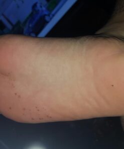 PURELY NORTHWEST-Natural Tea Tree & Peppermint Body Wash for Men & Women-Refreshing Daily Soap for Body Odor & Hygiene, Acne-Effectively Soothes Jock Itch, Chafing & Athletes Foot-Discolored Nails-9oz 9 Fl Oz (Pack of 1) 45 71Kj4bNGnLL