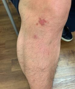 Silver Miracles Colloidal Silver Gel - Nano Silver Gel Wound Care - Healing Ointment for Burns, Sunburns & Irritated Skin - 4 Oz Unscented 40 71L26luweML 1