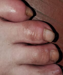 Aidance Skincare & Topical Solutions terrasil Anti-fungal Treatment MAX - 50g 31 71LO8m2GzL