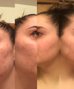 Organic African Black Soap - For Acne & Dark Spots | Natural Vegan and Cruelty Free – Satisfaction Guarantee 1lb bar | 90 day Supply 1 Pound (Pack of 1) 49 71LcwTsrBmL