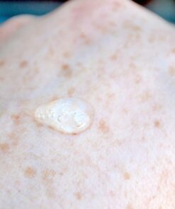 BENTON Snail Bee High Content Essence - Snail Secretion Filtrate & Bee Venom Contained Moisturizing Gel for Oily, Combination, Acne-Prone Skin - Dermatologically Tested, 2.02 fl. oz. 2.02 Fl Oz (Pack of 1) 40 71Lkogj6HnL