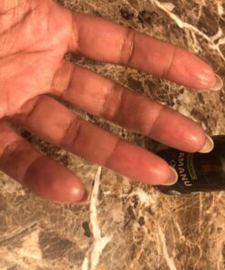 Cammile Q Organic Tamanu Oil - Natural Psoriasis Treatment - Great For Eczema, Acne & Scars - Cold Pressed 41 71LsFpKBbXL