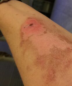 Structured Colloidal Silver Gel for Burns and Wounds - Cooling Silver Extra Strength 35ppm Silver Gel 33 71LyrbQsutL