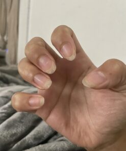 Nutra Nail 5 to 7 Day Growth Treatment - Fast Keratin Nail Hardener & Nail Strengthener for Thin Nails, Brittle & Damaged (0.47 Fl Oz) 0.50 Fl Oz (Pack of 1) 41 71M0FF7RBML 2