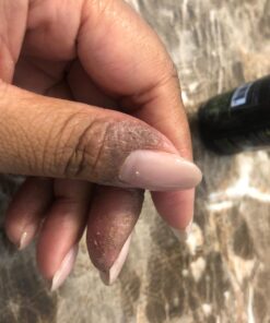 Cammile Q Organic Tamanu Oil - Natural Psoriasis Treatment - Great For Eczema, Acne & Scars - Cold Pressed 42 71MJLvVTML