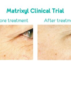 Anavita Moisturizing Anti Wrinkle Anti Aging Cream W/Peptide & Hyaluronic Acid - Day Night - Facial Fine Lines Wrinkles Elasticity Skin Tone - Face Neck Decollete Moisturizer for Women Men 1.7 fl oz 14 71Msy 6oRFL