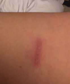 Active Skin Repair Hydrogel - Natural & Non-Toxic First Aid Ointment & Antiseptic Gel for Minor Cuts, Wounds, Scrapes, Rashes, Sunburns, and Other Skin Irritations (Single, 3 oz Gel) 3 Fl Oz (Pack of 1) 50 71N3TvFMtzL