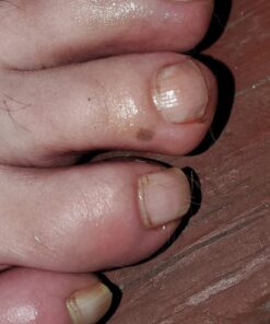 Aidance Skincare & Topical Solutions terrasil Anti-fungal Treatment MAX - 50g 32 71NBs3q1VL