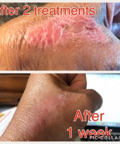 Active Skin Repair Hydrogel - Natural & Non-Toxic First Aid Ointment & Antiseptic Gel for Minor Cuts, Wounds, Scrapes, Rashes, Sunburns, and Other Skin Irritations (Single, 3 oz Gel) 3 Fl Oz (Pack of 1) 52 71NUmCWfm5L