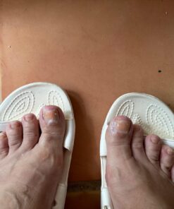 Fungi Nail Anti-Fungal Ointment, Kills Fungus That Can Lead to Nail & Athlete’s Foot with Tolnaftate & Clinically Proven to Cure Infections, Natural Color, 0.7 Fl Oz 29 71Nl27E3hIL