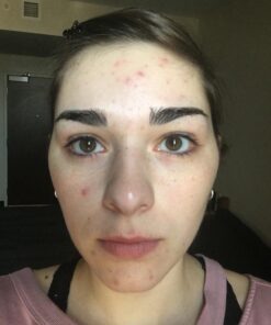 Face Wash, Facial Cleanser, Oil Cleanser - Helps as a Blackhead Remover with Organic Rosemary Oil, Shea Butter and Aloe Vera - Gentle Facewash To Soften, Soothe & Balance Skin, Made in USA, 4oz 32 71OAm3RSnxL