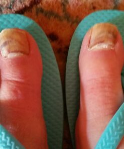 Eve Hansen Organic Tea Tree Oil (4oz) | Melaleuca Alternifolia | Pure Tea Tree Essential Oil for Skin, Scalp, Nails and Aromatherapy 40 71OJqyb6vpL