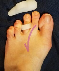 Dr. Frederick's Original Hammer Toe Gels - 4pcs - Support Crest for Women & Men - Joint Realign - Cushion, Support & Temporary Splint - Crooked, Claw, Diabetic Brace - One Loop Design 1 Loop 23 71OvUwTiuVL