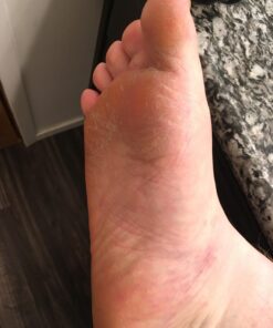 Microplane Colossal Foot File Scraper - The Original Stainless Steel Foot Rasp, Dead Skin/Callus Remover for Feet, Gentle Foot Scrubber, Pedicure Tools for Salon-Quality Foot Care, Black 53 71OxgQNqiTL