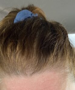 PURA D'OR Professional Grade Biotin Anti-Hair Thinning Shampoo & Conditioner, CLINICALLY TESTED Proven Results, 2X Concentrated DHT Blocker Thickening Products For Women & Men, Sulfate Free, 16oz x 2 30 71PwCoDGHnL 2