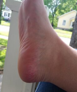 Microplane Colossal Foot File Scraper - The Original Stainless Steel Foot Rasp, Dead Skin/Callus Remover for Feet, Gentle Foot Scrubber, Pedicure Tools for Salon-Quality Foot Care, Black 63 71Q8uLM77AL