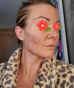 Sports Research Vitamin D3 5000 IU with Coconut MCT Oil - High Potency Vitamin D Supplement for Immune & Bone Support - Non-GMO Verified, Gluten & Soy Free – 125mcg, 360 Liquid Softgels 360 Count (Pack of 1) 38 71QFKraWp L