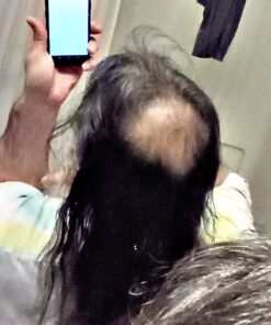 6 Months Kirkland Minoxidil 5% Extra Strength Hair Loss Regrowth Treatment Men, 12 Fl Oz (Pack of 6) 44 71QJLvO4ldL