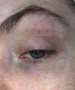 Hydrating Face Moisturizer & Body Cream with Manuka Honey Cream - Organic Face Moisturizer & Body Lotion for Extremely Dry Skin - For Dry & Itchy Skin, Rosacea & Eczema Prone Skin (Original, 2oz) Original 2 Ounce (Pack of 1) 45 71QYLieZaCL 1