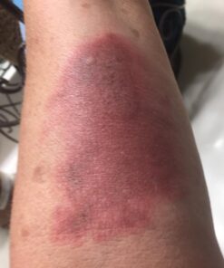 Structured Colloidal Silver Gel for Burns and Wounds - Cooling Silver Extra Strength 35ppm Silver Gel 34 71QbTw6dtTL