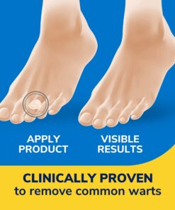 Dr. Scholl's Clear Away WART Remover HYDROGEL Bandage // 12 Discs/9 Cushions, Clinically Proven, Immediate & All-Day Cushioning Pain Relief, Multi-Day Coverage, 12 Treatments 24 71ROcNd9BML