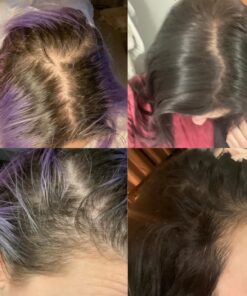 Sugarbear Hair Vitamins Extra Strength Biotin 6000mcg, Vitamin C, E, Coconut Oil, Zinc, Folic Acid, Inositol - Vegan Gummies for Luscious Hair and Nails - Supplement for Women & Men (1 Month Supply) 60 Count (Pack of 1) 39 71RoWo9cQEL