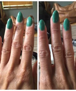 Natrol Biotin Beauty Tablets, Promotes Healthy Hair, Skin and Nails, Helps Support Energy Metabolism, Helps Convert Food Into Energy, Maximum Strength, 10,000mcg, 100 Count (Pack of 1) 100 Count (Pack of 1) 33 71SCG7OqBbL