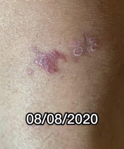 Silver Miracles Colloidal Silver Gel - Nano Silver Gel Wound Care - Healing Ointment for Burns, Sunburns & Irritated Skin - 4 Oz Unscented 41 71TLMMNpGRL 1