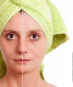 Cammile Q Organic Tamanu Oil - Natural Psoriasis Treatment - Great For Eczema, Acne & Scars - Cold Pressed 34 71TQfrii dL