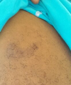 Aidance Skincare & Topical Solutions terrasil Anti-fungal Treatment MAX - 50g 34 71TdbLWLaDL